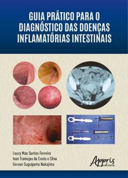 Imagem de GUIA PRATICO PARA O DIAGNOSTICO DAS DOENCAS INFLAMATORIAS INTESTINAIS