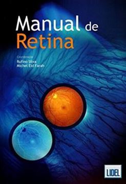 Imagem de MANUAL DE RETINA