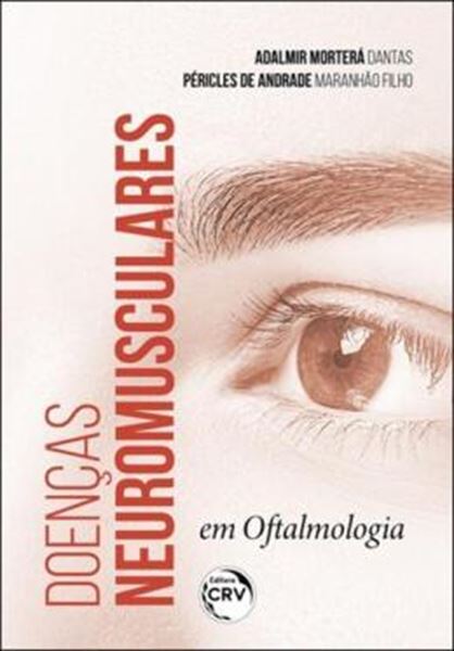Picture of DOENCAS NEUROMUSCULARES EM OFTALMOLOGIA