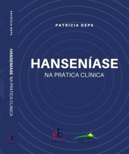 Picture of HANSENIASE NA PRATICA CLINICA