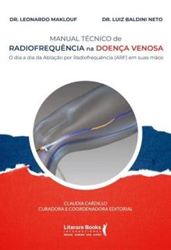 Imagem de MANUAL TECNICO DE RADIOFREQUENCIA NA DOENCA VENOSA