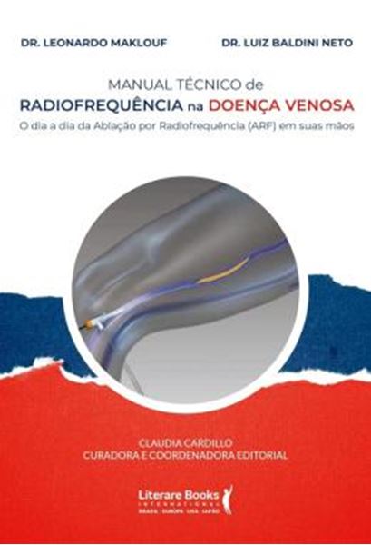 Picture of MANUAL TECNICO DE RADIOFREQUENCIA NA DOENCA VENOSA
