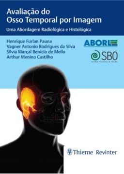Imagem de AVALIACAO DO OSSO TEMPORAL POR IMAGEM