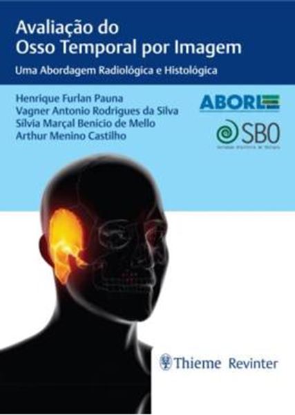 Picture of AVALIACAO DO OSSO TEMPORAL POR IMAGEM