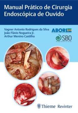 Imagem de MANUAL PRATICO DE CIRURGIA ENDOSCOPICA DE OUVIDO