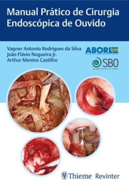 Picture of MANUAL PRATICO DE CIRURGIA ENDOSCOPICA DE OUVIDO