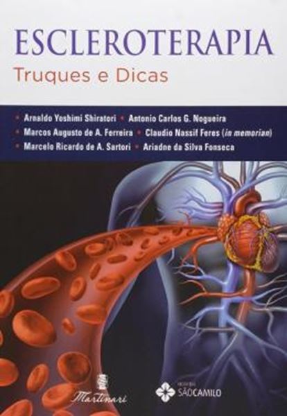 Picture of ESCLEROTERAPIA - TRUQUES E DICAS