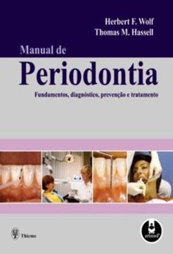 Imagem de MANUAL DE PERIODONTIA