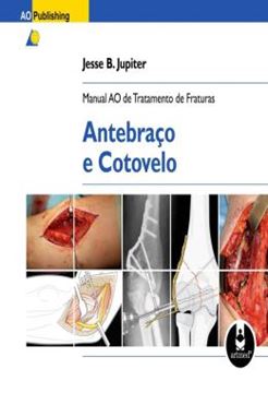 Imagem de MANUAL AO DE TRATAMENTO DE FRATURAS - ANTEBRACO E COTOVELO