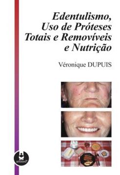 Imagem de EDENTULISMO, USO DE PROTESES TOTAIS E REMOVIVEIS E NUTRICAO