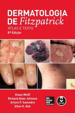 Imagem de DERMATOLOGIA DE FITZPATRICK - 8ª ED