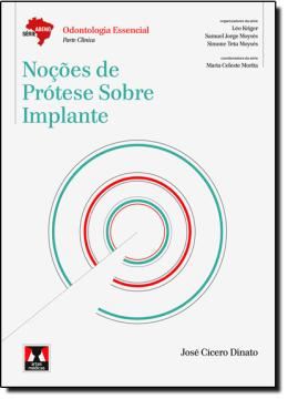 Imagem de NOCOES DE PROTESE SOBRE IMPLANTE