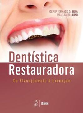 Imagem de DENTISTICA RESTAURADORA - DO PLANEJAMENTO A EXECUCAO