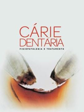 Imagem de CARIE DENTARIA - FISIOPATOLOGIA E TRATAMENTO - 3ª ED