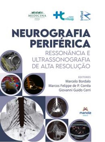 Picture of NEUROGRAFIA PERIFERICA - RESSONANCIA E ULTRASSONOGRAFIA DE ALTA RESOLUCAO