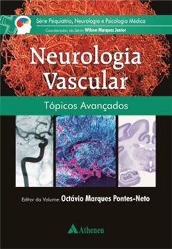 Imagem de NEUROLOGIA VASCULAR