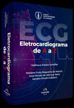Imagem de ELETROCARDIOGRAMA DE A A Z