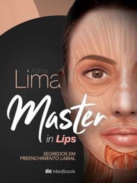 Imagem de MASTER IN LIPS - SEGREDOS EM PREENCHIMENTO LABIAL