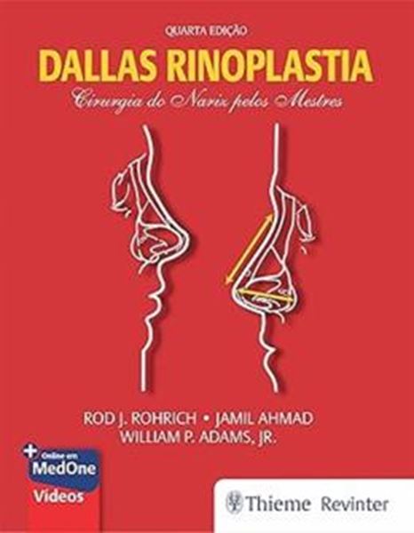 Picture of DALLAS RINOPLASTIA