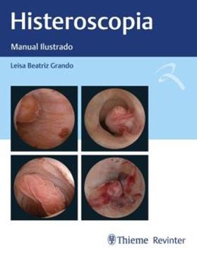 Imagem de HISTEROSCOPIA