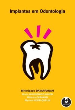 Imagem de IMPLANTES EM ODONTOLOGIA 