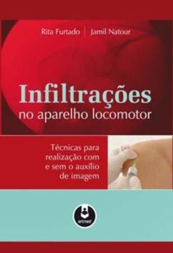 Imagem de INFILTRACOES NO APARELHO LOCOMOTOR