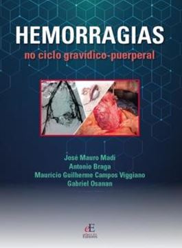 Imagem de HEMORRAGIAS DO CICLO GRAVIDICO PUERPERAL