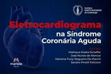 Imagem de ELETROCARDIOGRAMA NA SINDROME CORONARIA AGUDA