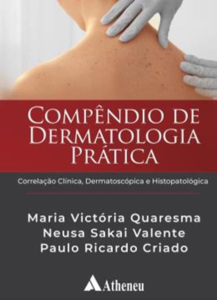 Picture of COMPENDIO DE DERMATOLOGIA PRATICA - CORRELACAO CLINICA, DERMATOSCOPICA E HISTOPATOLOGICA