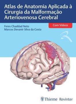 Imagem de ATLAS DE ANATOMIA APLICADA A CIRURGIA DA MALFORMACAO ARTERIOVENOSA CEREBRAL
