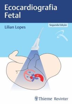 Imagem de ECOCARDIOGRAFIA FETAL