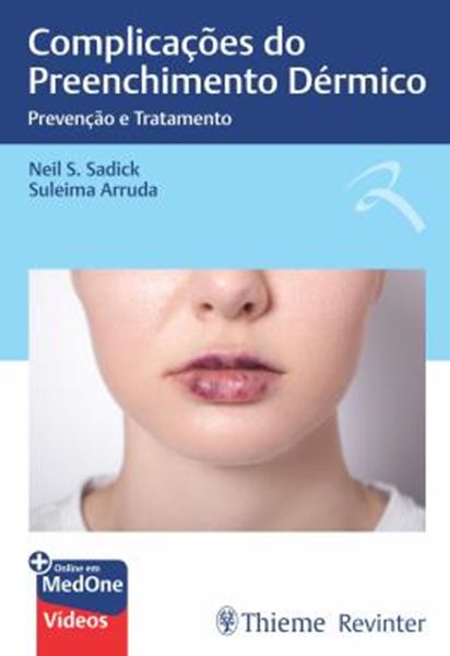 Picture of COMPLICACOES DO PREENCHIMENTO DERMICO - PREVENCAO E TRATAMENTO