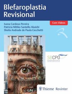 Imagem de BLEFAROPLASTIA REVISIONAL