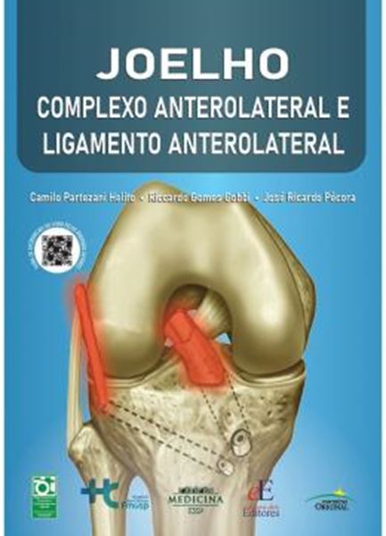 Picture of JOELHO : COMPLEXO ANTEROLATERAL E LIGAMENTO ANTEROLATERAL