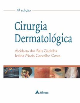Imagem de CIRURGIA DERMATOLOGICA